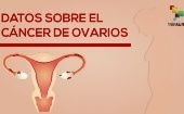 Cifras del cáncer de ovario