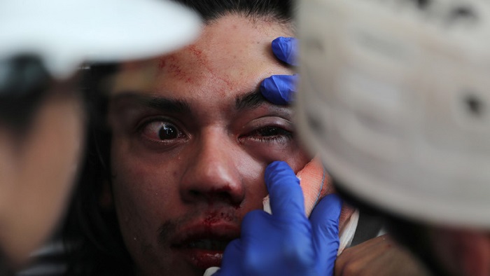 Anteriormente, el Instituto de Derechos Humanos de Chile, había indicado en su último reporte que 352 personas habían sufrido lesiones oculares.