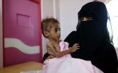 La malnutrición y la hambruna provocadas por la guerra ha cobrado la vida de casi 85.000 niños yemeníes hasta octubre de 2018.