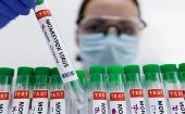 Las autoridades sanitarias panameñas han reforzado la vigilancia epidemiológica ante el incremento de casos de viruela símica.