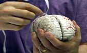 Los expertos realizaron estudios para conocer cómo se desarrolla el cerebro humano durante la etapa comprendida entre los 8 a 23 años.